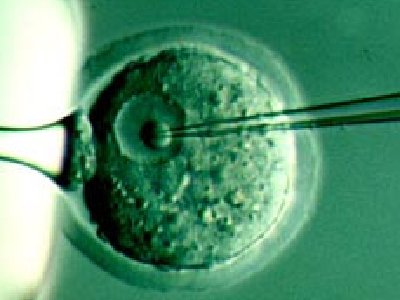 Consejo Nacional de Investigación Médica autoriza la primera licencia para la clonación