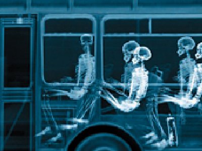 Los rayos-X son el mejor invento de la historia