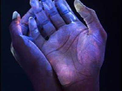 Te descubrieron por una bacteria!