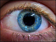 ojo