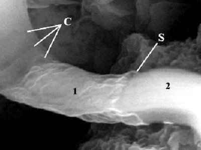 Científico miente en publicación internacional indicando que encontró fósiles aliens en un meteorito
