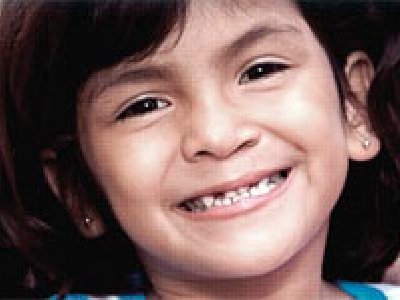 Solidaridad: Ayuda a Pepsi y a la Operación Sonrisa con un click