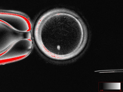 Científicos crean óvulos funcionales a partir de células de piel humana