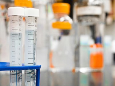 Prueba de sangre detecta cáncer de cabeza y cuello por VPH hasta 10 años antes